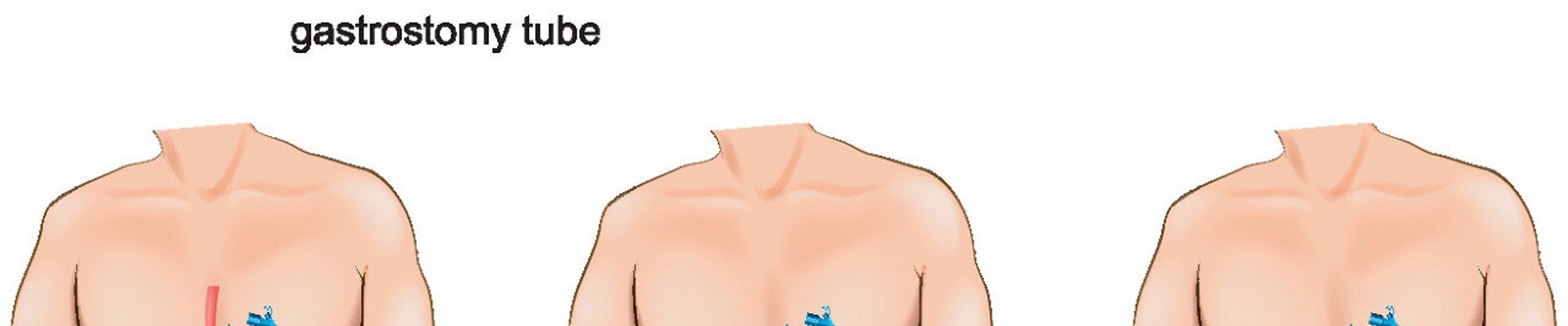 球盟会联系我们